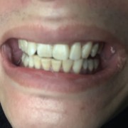 zxm12345678914